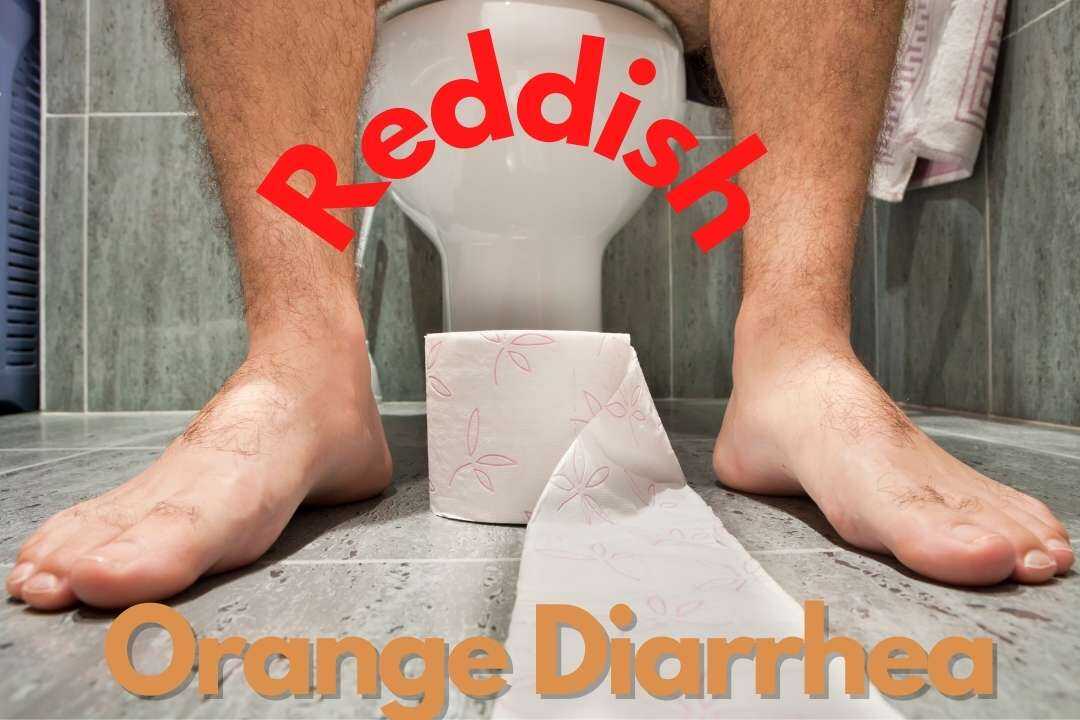 Understanding Orange Diarrhea: Causes and When to Seek Medical Advice